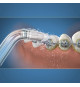 Embout Hydropulseur - WATERPIK - Orthodontique - Élimine la plaque - Spécial appareils dentaires