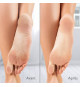 Râpe électrique anti-callosités Silk'n Vacupedi avec aspiration intégrée et 2 râpes incluses